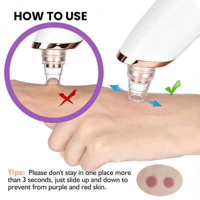 Vacuum Pore Cleaner - Remove Blackheads Without Irritation or Redness
