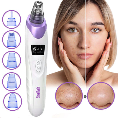 Vacuum Pore Cleaner - Remove Blackheads Without Irritation or Redness