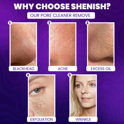 Vacuum Pore Cleaner - Remove Blackheads Without Irritation or Redness